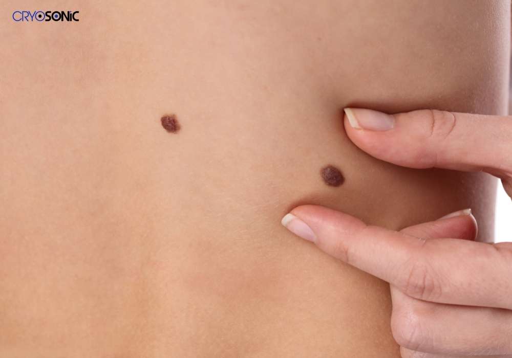 Infection Risk and Poor Aftercare Swindon