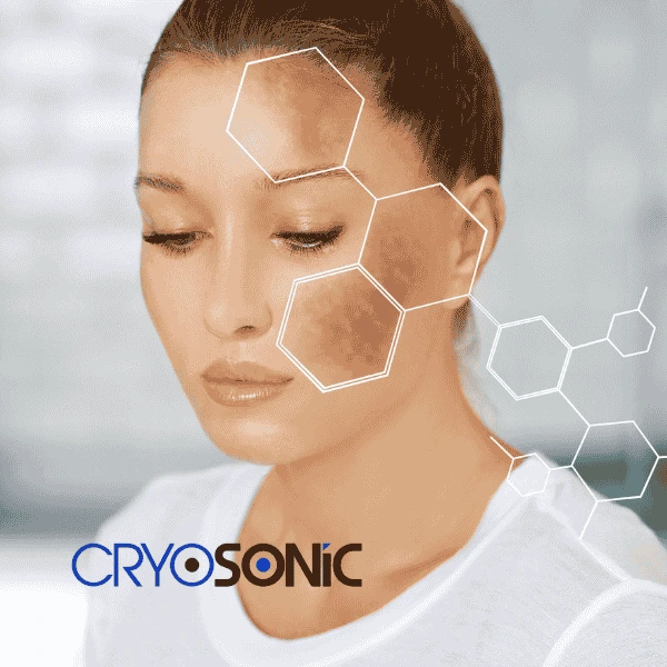 Are you looking for age spot removal treatment? Contact Cryosonic today in Swindon
