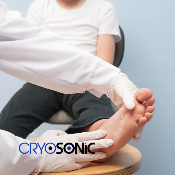 Are you looking for fast effective wart removal Contact us today Swindon